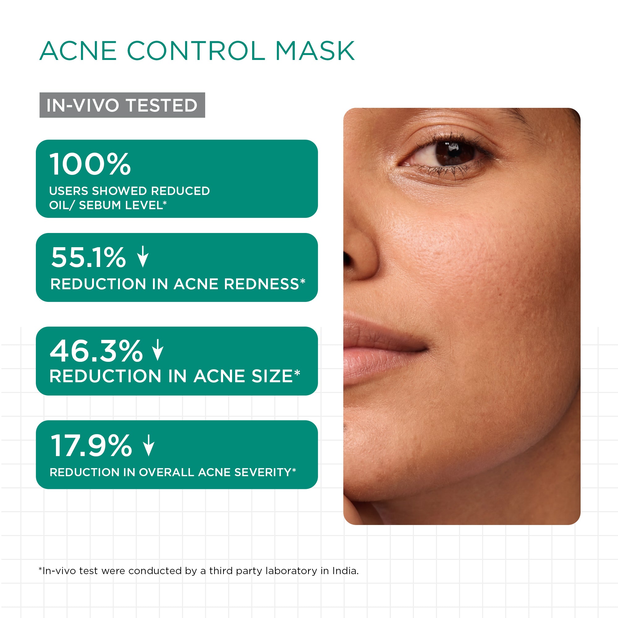 Acne Combo